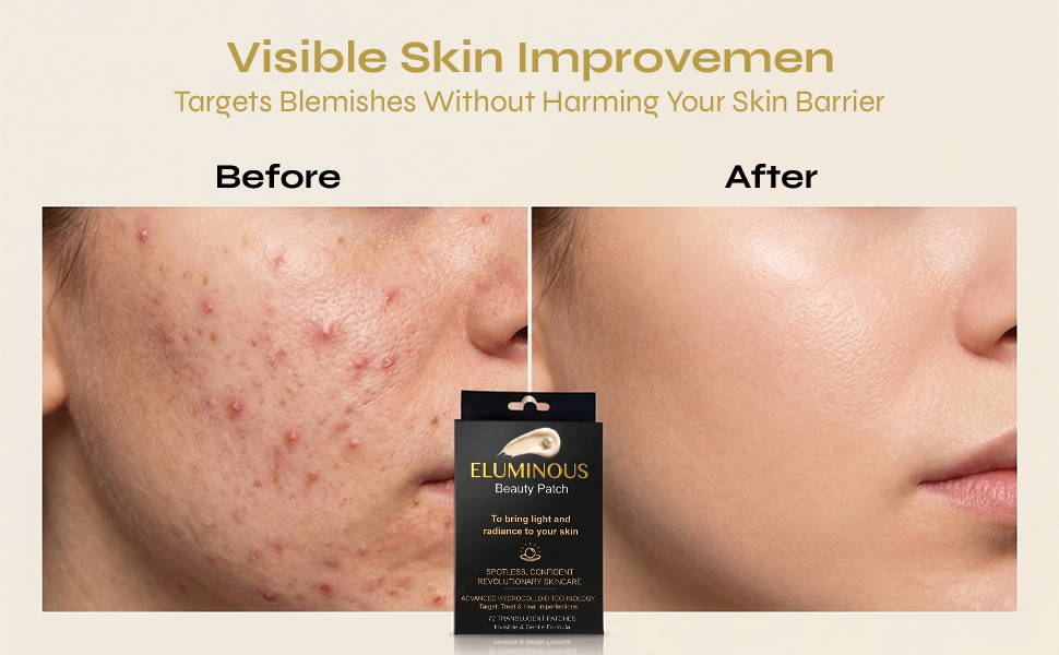 Beauty Acne Patch